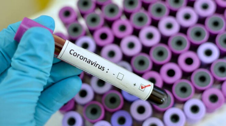 Serie A a rischio Coronavirus